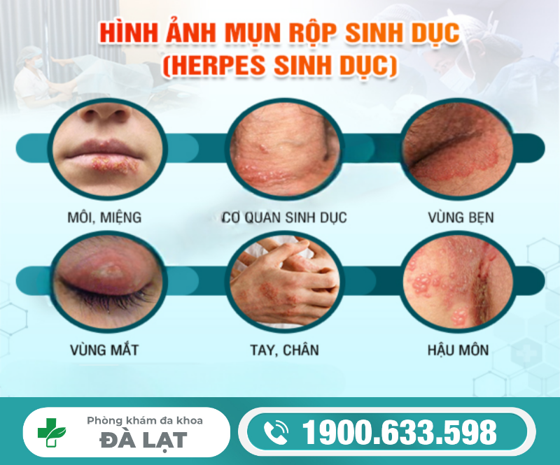 Hình ảnh minh họa